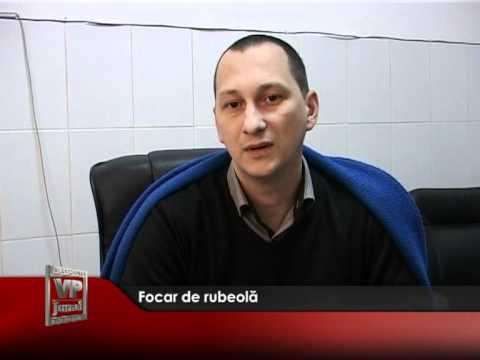 Focar de rubeolă
