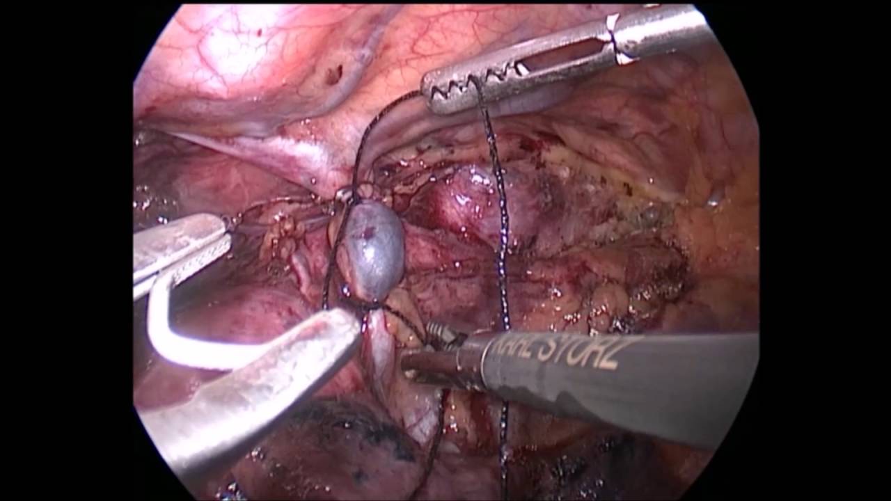 Diego Nunes De Albuquerque Oliveira-0