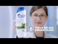 Gatal Karena Ketombe Basah Move On Ke Head Shoulders Sekarang