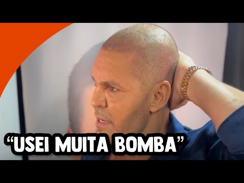 EDUARDO COSTA REVEALS WHY HE WENT BALD