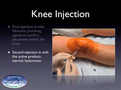Im Finger Gelenkschmerzen Massage TMJ