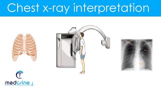 Basic Skills for Chest X-ray  interpretation