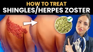 Quick Tips to NEVER get Shingles | Herpes Zoster | Dr. (h.c.) Palak Midha