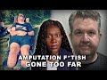 The Surgeon Who PURPOSELY Amputated His Legs For S Xual F Tish Neil Hopper