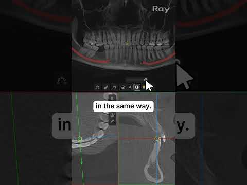 SMARTDent : 5D Tutorial #2-6. 2D View Optimization & Enhancement Features