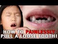 How To Pull A Loose Tooth | No Cry Teeth Pulling Method | Easily Extract Baby Teeth