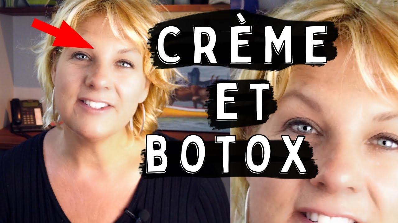 botox avant-apres | ride du lion