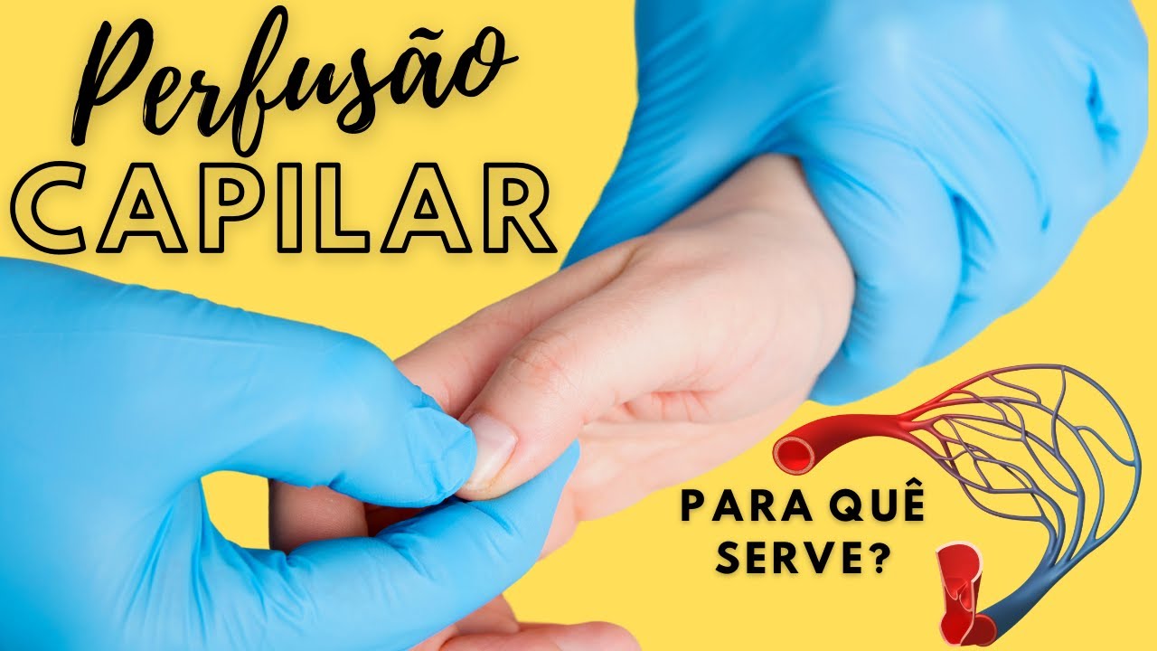 PERFUSÃO CAPILAR - Saiba a Importância desse Exame