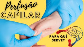 PERFUSÃO CAPILAR - Saiba a Importância desse Exame