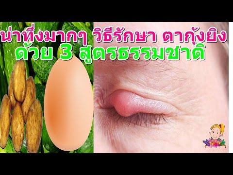 มันฝรั่งต้มในโรคสะเก็ดเงิน ครีมยาจีนสำหรับโรคสะเก็ดเงิน