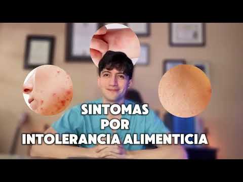 Síntomas por intolerancia alimenticia Dr. Rodrigo Campos