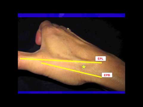 Cpt Code For Cmc Joint Injection