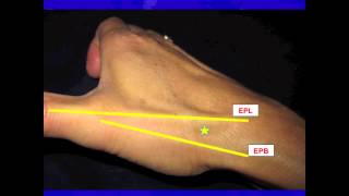 Thumb Carpal-Metacarpal (CMC) Joint injection