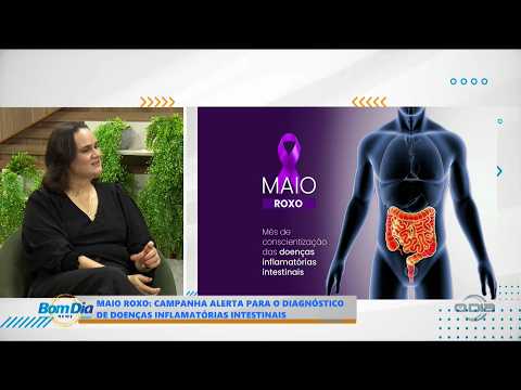 O Dia TV