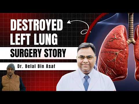 Destroyed Left Lung Surgery Story | Dr. Belal Bin Asaf Explains