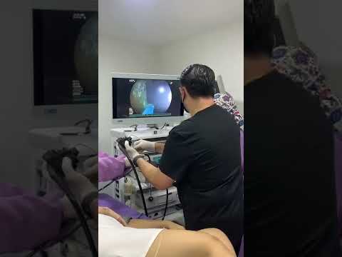 Dr. Edilberto Almanza gastroenterólogo Barranquilla