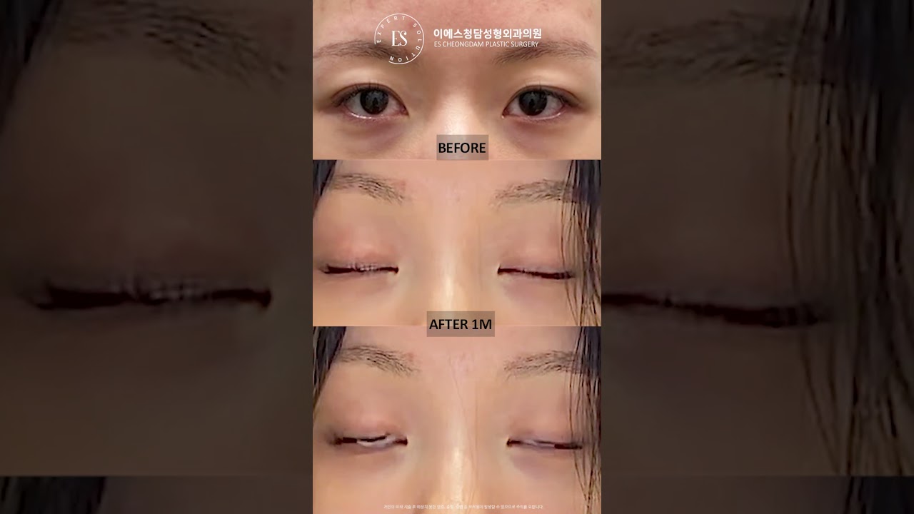 이에스 유튜브
