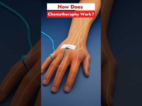 How does chemotherapy work?