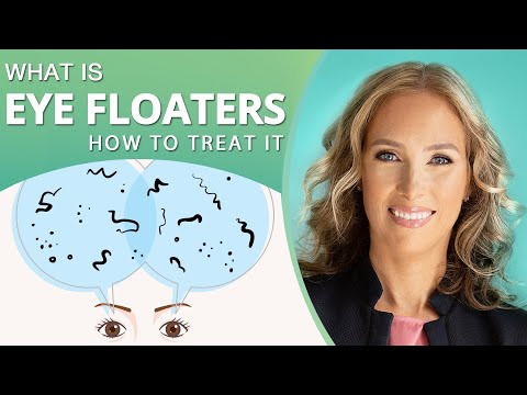 What Are Eye Floaters | How to Treat Eye Floaters Naturally | Dr. J9 Live