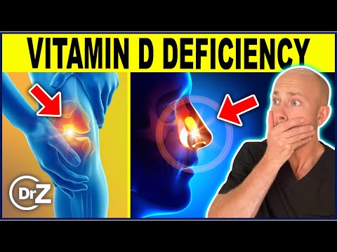10 Warning Signs of Vitamin D Deficiency You MUST Know About