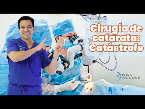 Cirugía de catarata: catástrofe