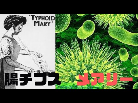 腸チフスについて詳しく解説