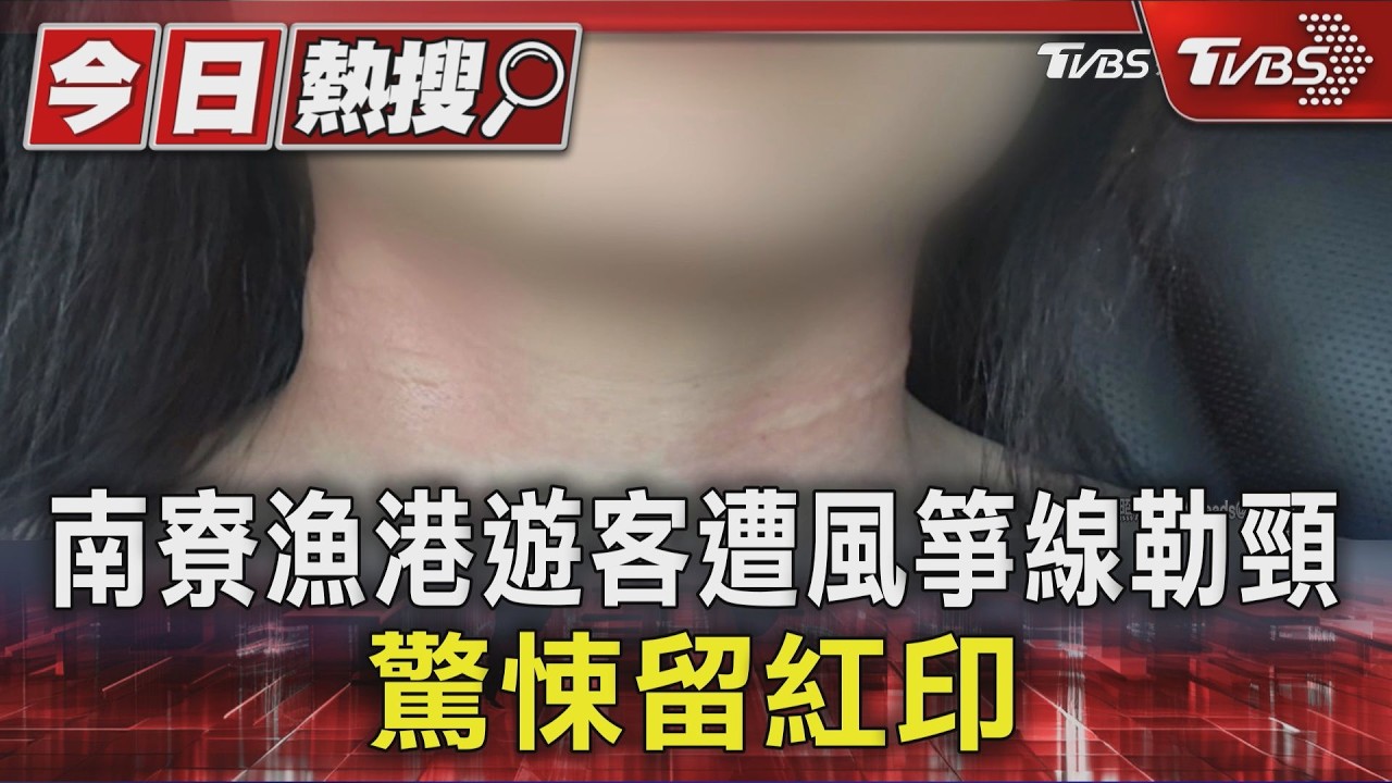 南寮漁港遊客遭風箏線勒頸 驚悚留紅印|TVBS新聞 @TVBSNEWS01