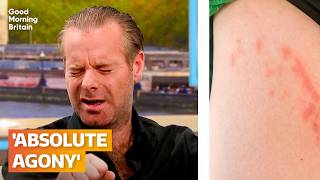 Man suffers severe burns to groin on flight to London