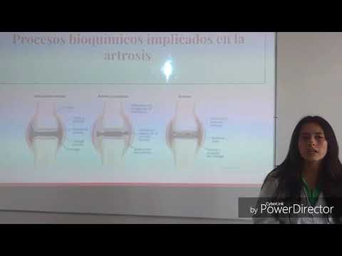 EPI artrosis de rodilla.