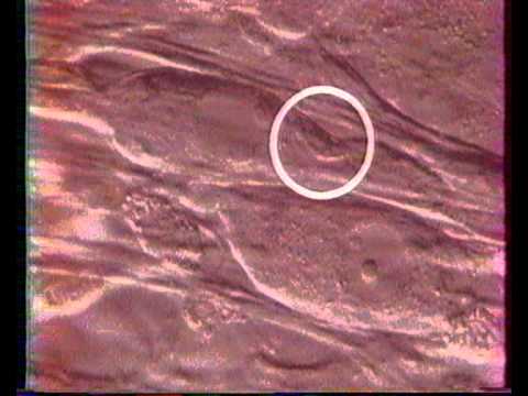 3 cellules de Schwan et myeline, construction cerveau