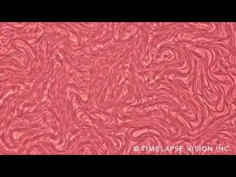 フソバクテリウムについて詳しく解説