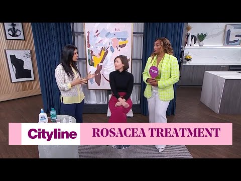 A dermatologist's guide to treat rosacea