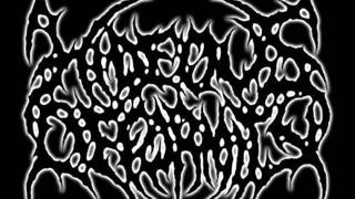 Hideous Deformity-Mr. Tumour&#39;s Misery (Cadaver cover)