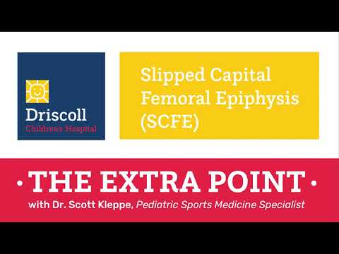 Slipped Capital Femoral Epiphysis (SCFE) - The Extra Point with Dr. Scott Kleppe
