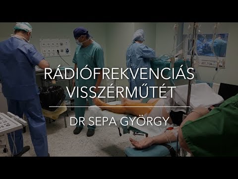 Visszér kezelése az alaplap véleményeiben