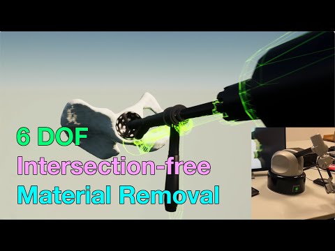 6-DOF Intersection-free Haptic Rendering with Material Removal for Hip Surgery Simulation