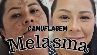 Camuflando manchas de melasma.