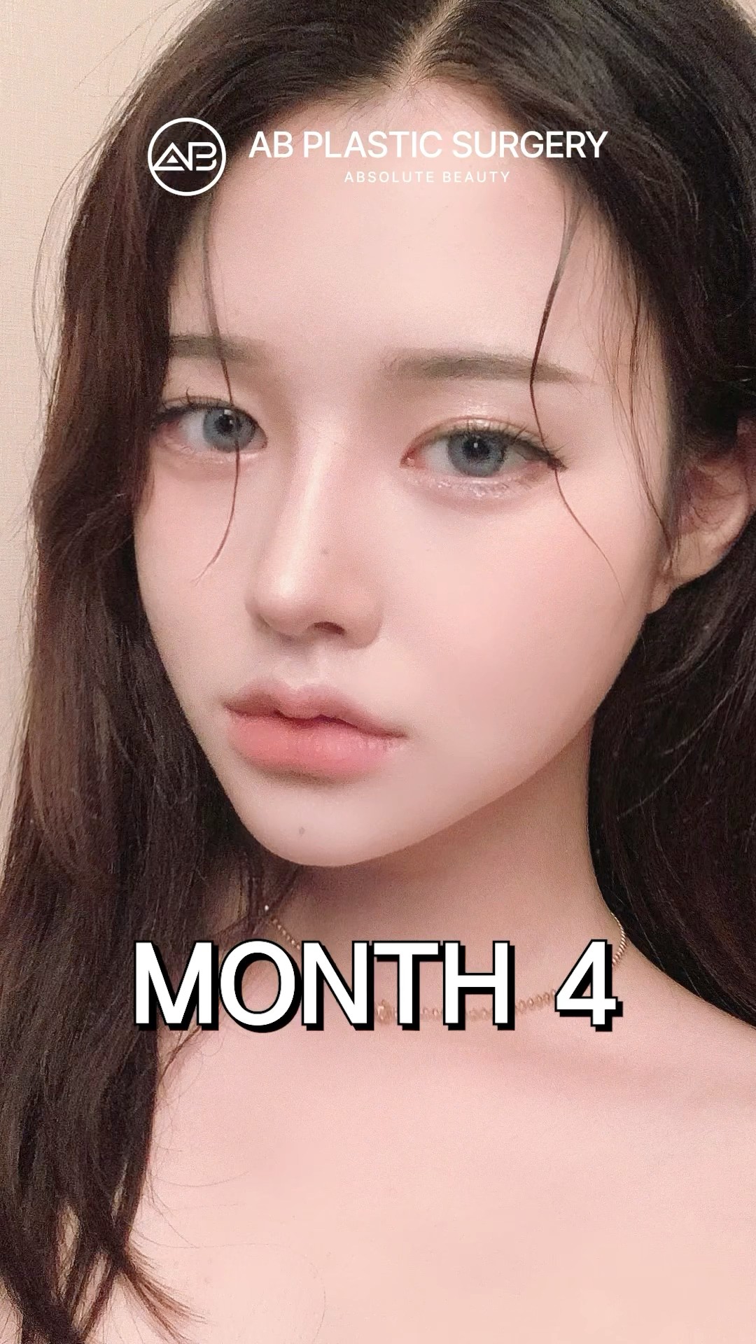 Nose&Facial Contouring Surgery in Korea