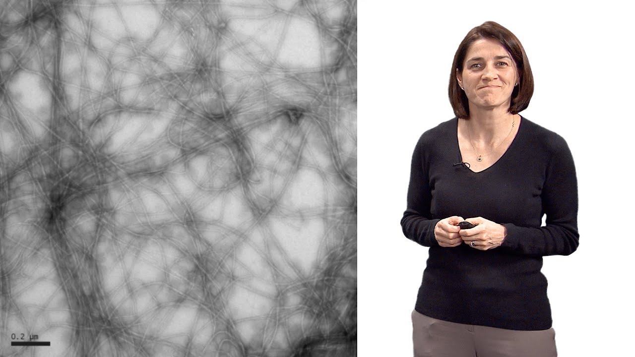 Christine Jacobs-Wagner (Yale, HHMI) 1: The role of spatial organization in bacterial cell function