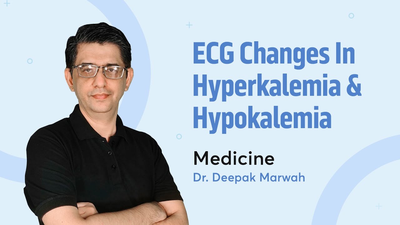 ECG changes in Hyperkalemia and Hypokalemia | Dr. Deepak Marwah | Medicine | PrepLadder