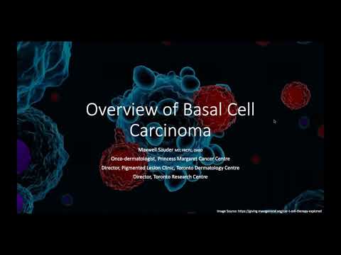 image-How common is basal cell carcinoma in the US?