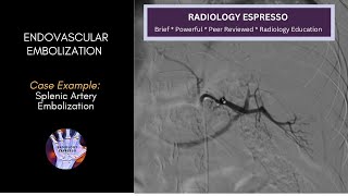 ENDOVASCULAR EMBOLIZATION: Case Example - Splenic Artery Embolization
