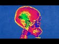 A Farmer Mistakenly Drank His Own Herbicide This Is What Happened To His Brain