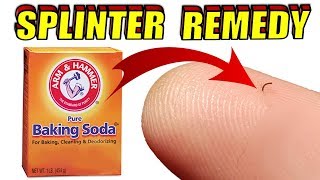 How to Remove a Splinter With Baking Soda