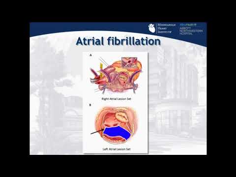 SAVR is Still Relevant and Needed for Many - Mario Goessl, MD