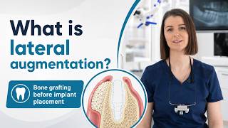 Lateral Augmentation