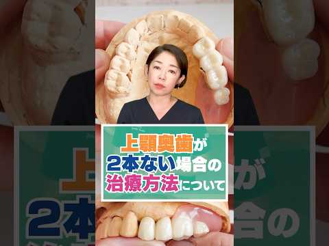 上顎奥歯のインプラントができない・したくない方へ 〜上顎奥歯が2本ない場合の治療方法について〜