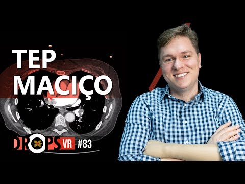 PROTOCOLO TEP  RECONHECENDO TROMBOSE MACIÇA NA PRÁTICA