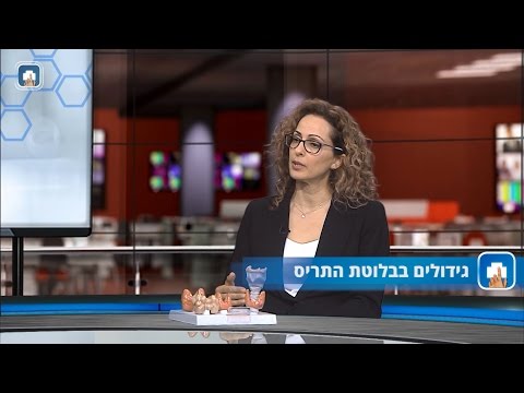 גידולי בלוטת התריס-תירואיד: המילון הרפואי