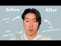 QOVES Facial Analysis Review Is It Actually Worth It